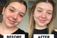 Vitamin c serum before and after