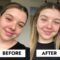 Vitamin c serum before and after