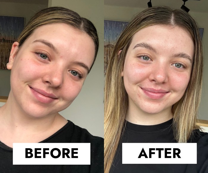Vitamin c serum before and after