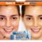 Retinol benefits for wrinkles