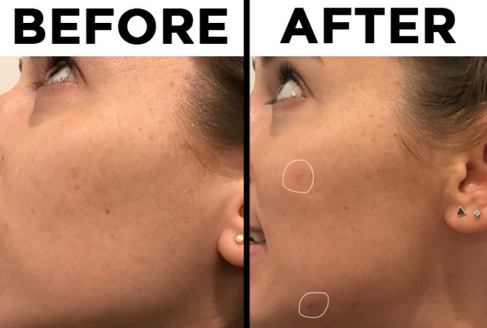 Beauty | The Ordinary Skincare Review | Rachel Emily